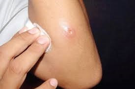 شبکه بهداشت و درمان درگز